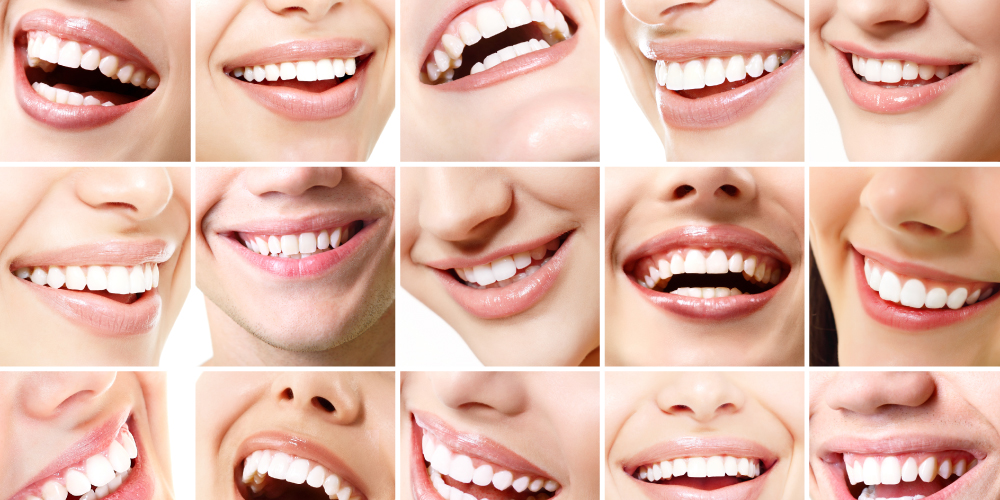 sonrisa